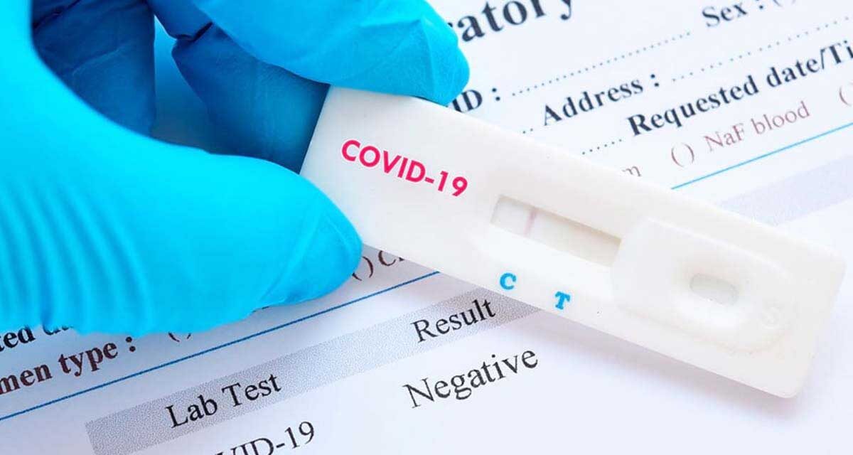 Sanidad recuerda que los test rápidos de anticuerpos no sirven para saber si una persona está enferma por covid-19 o si puede contagiar a los demás