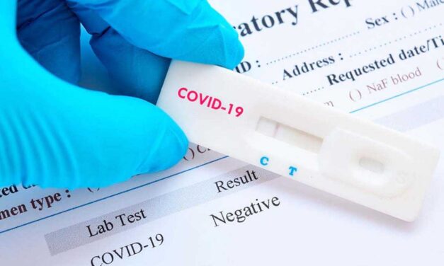 Sanidad recuerda que los test rápidos de anticuerpos no sirven para saber si una persona está enferma por covid-19 o si puede contagiar a los demás